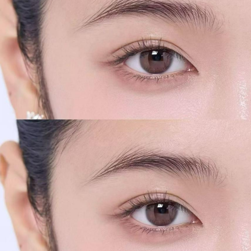 PerfectTouch Facial